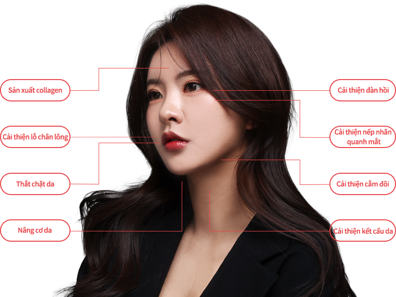 oligio region model img