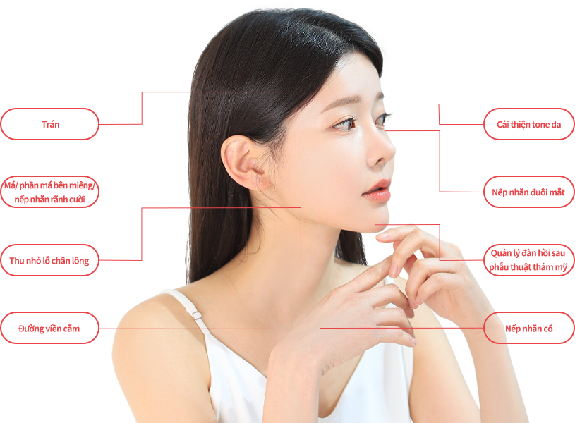 ulthera region model img