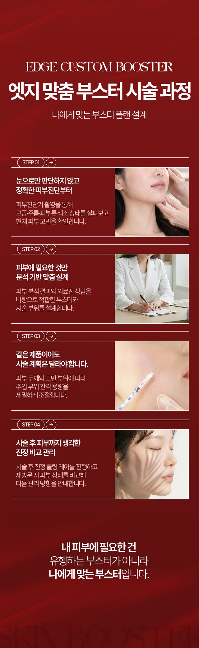 피부 진단 맞춤 설계 시술 계획 진정 관리로 이어지는 부스터 시술 과정