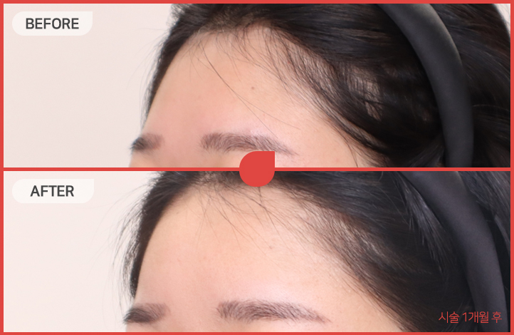 45度