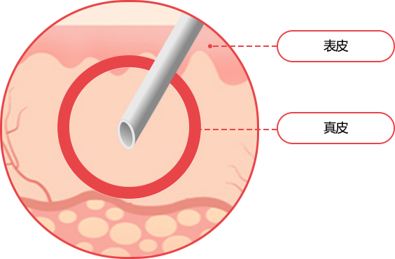 hand_img02 comparison02