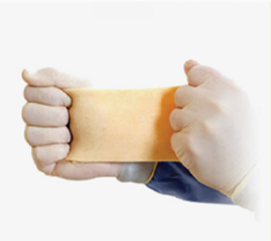 rhinoplasty_img07 img