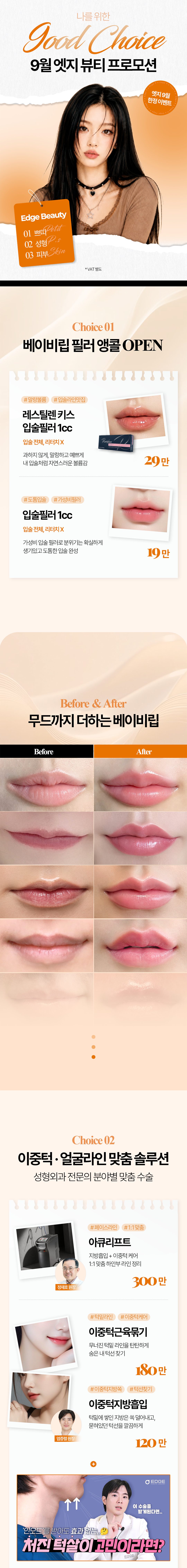 엣지성형외과 8월 이벤트 가격 및 의료진 안내-1