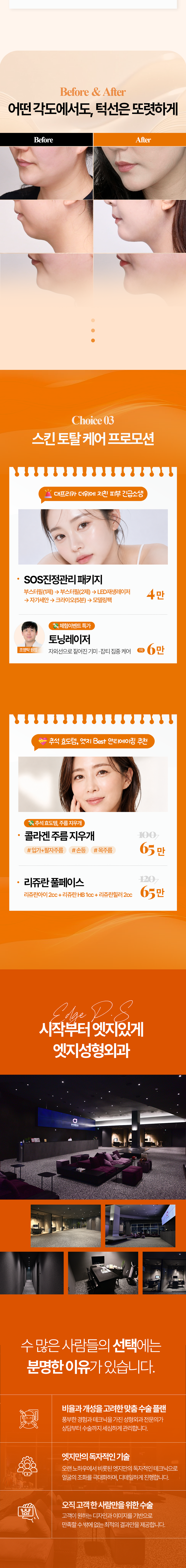 엣지성형외과 8월 이벤트 가격 및 의료진 안내-3