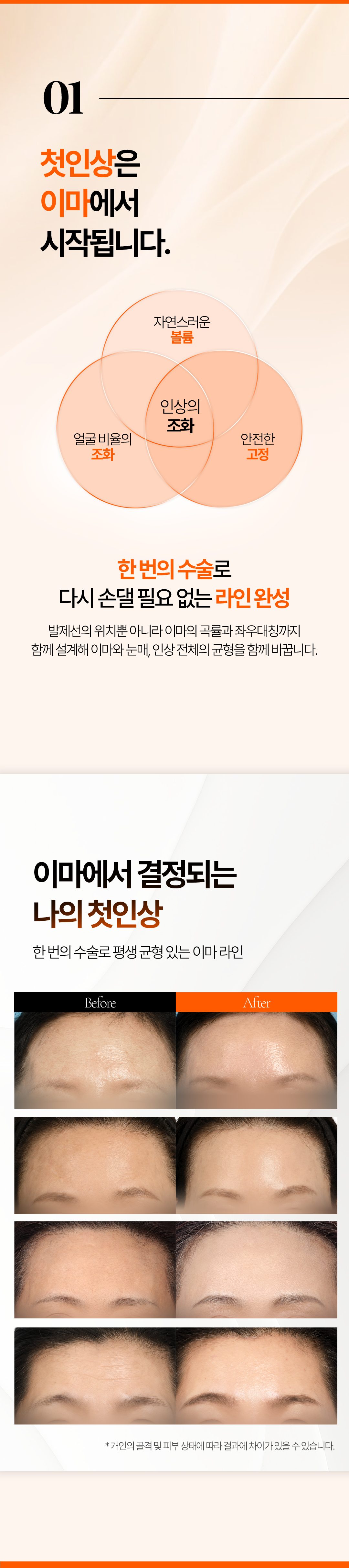 [8월] 엣지 안티에이징 리프팅 솔루션-2