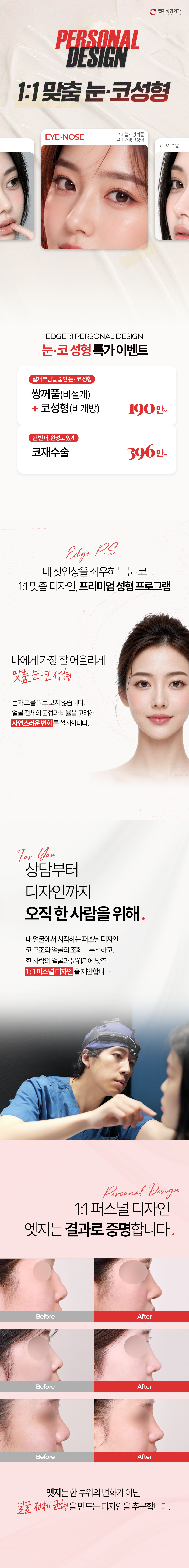 [8월] 1:1 맞춤 디자인 눈·코성형-1