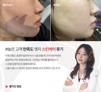 엣지성형외과&피부과 스킨케어 후기