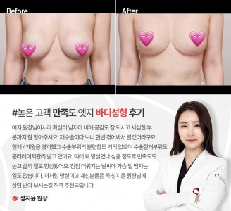 엣지성형외과&피부과 바디성형 후기