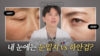 [40대 눈밑성형] 눈밑지방·처짐으로 나이 들어 보인다면 무조건 하안검일까? 성형외과 전문의가 알려주는 '진짜' 기준