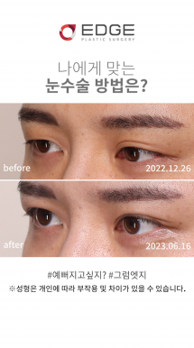 또렷한 눈 만들기