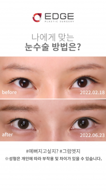 눈매 부드럽게 사랑스럽개