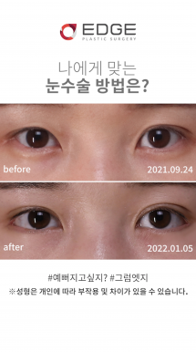 더 예뻐지는 법✨ #듀얼트임
