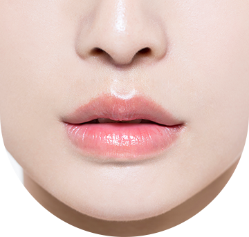 lip_lift07