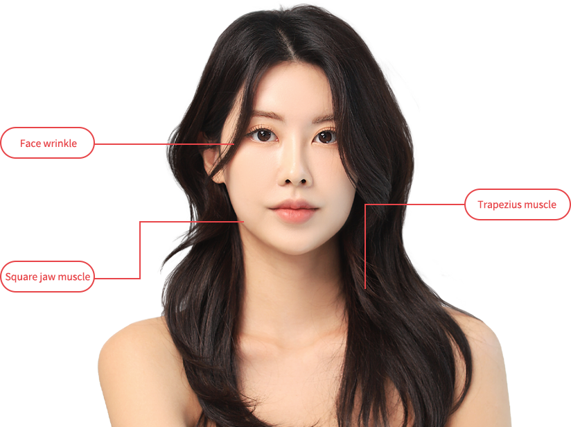 BotulinumToxin region model img