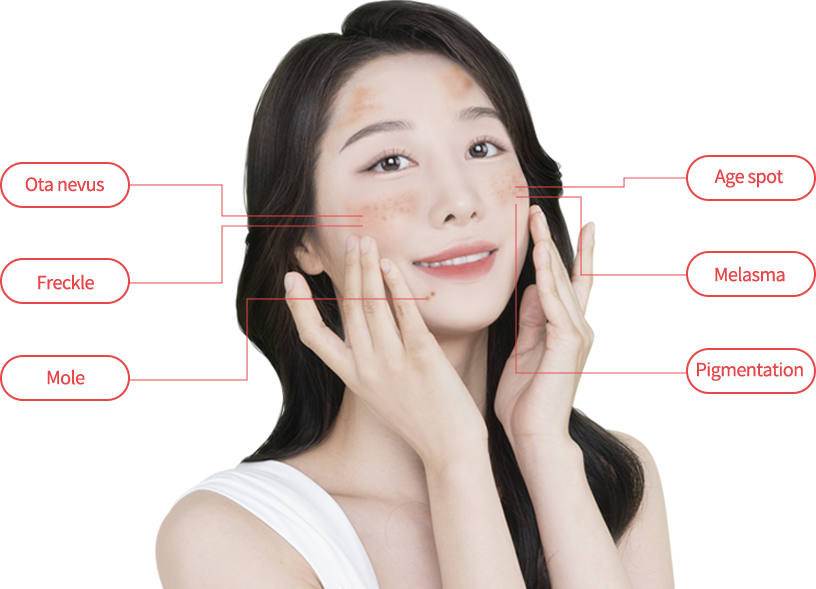 mobile region model img