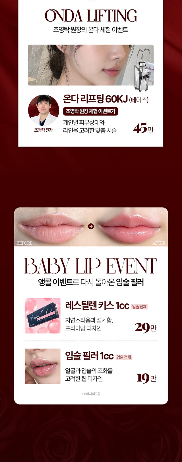 온다 리프팅과 베이비립 입술 필러 프로모션 안내