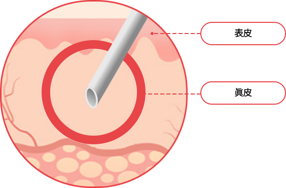 hand_img02 comparison02