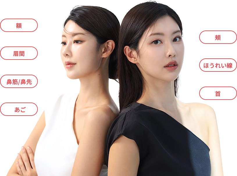 radiesse region model img