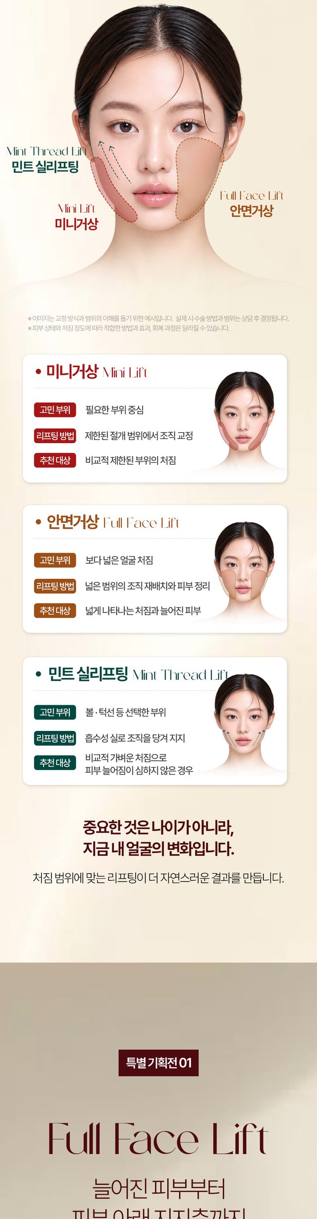 얼굴 처짐 부위에 따른 미니거상 안면거상 민트 실리프팅 안내