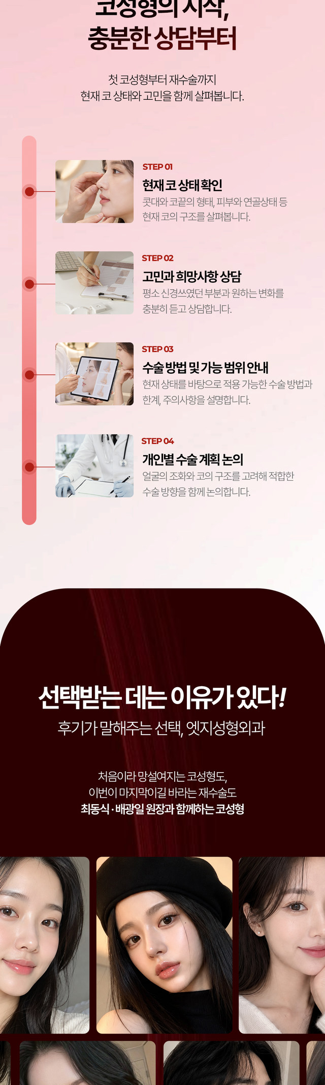 엣지성형외과 첫 코성형 및 코재수술 안내 5-3