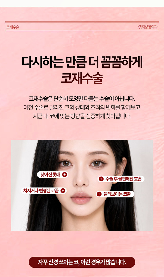 엣지성형외과 첫 코성형 및 코재수술 안내 3-2