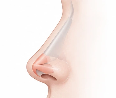 코끝 구조를 단순화한 설명 그림