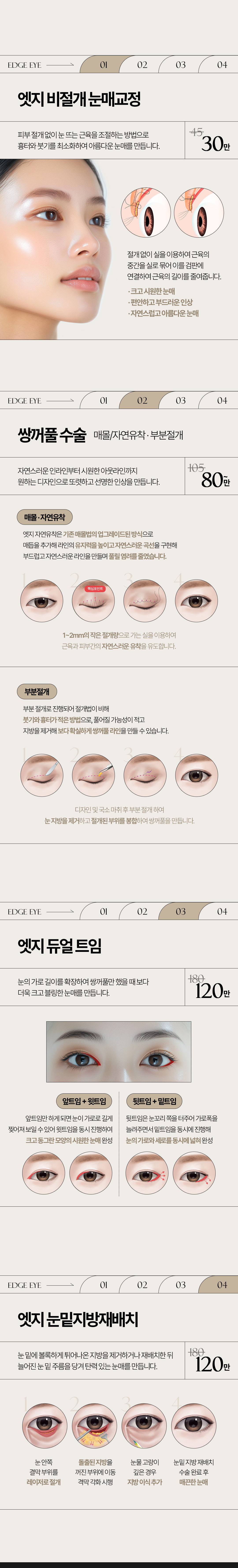 비절개 눈매교정, 자연유착 매몰법과 부분절개, 듀얼 트임, 눈밑지방재배치 안내