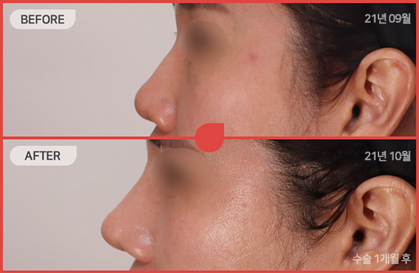 ด้านข้างของใบหน้า