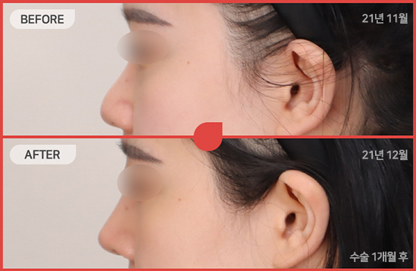 ด้านข้างของใบหน้า