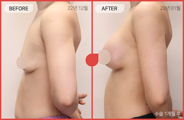 ด้านข้างของใบหน้า