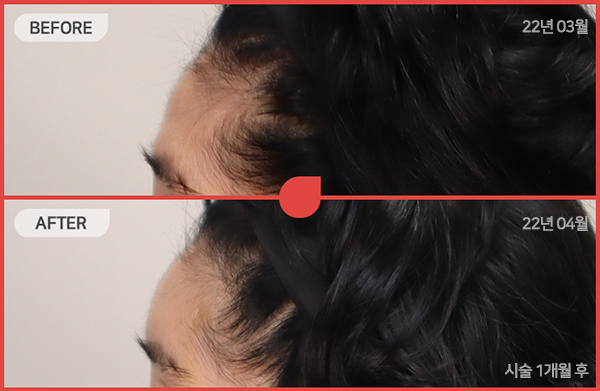 ด้านข้างของใบหน้า