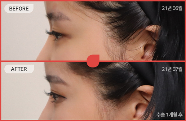 ด้านข้างของใบหน้า