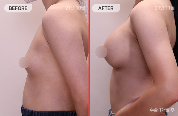 ด้านข้างของใบหน้า