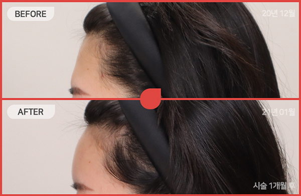 ด้านข้างของใบหน้า