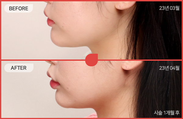 ด้านข้างของใบหน้า