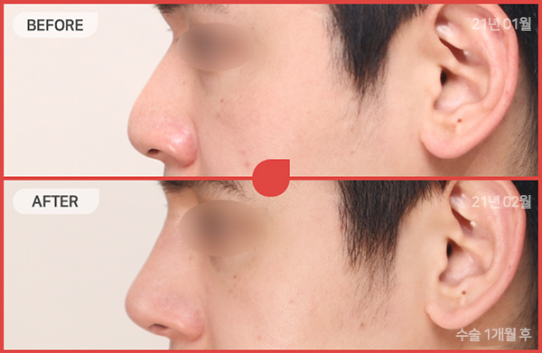 ด้านข้างของใบหน้า