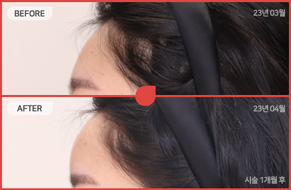 ด้านข้างของใบหน้า