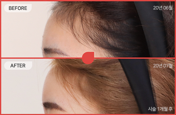 ด้านข้างของใบหน้า