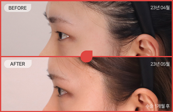 ด้านข้างของใบหน้า