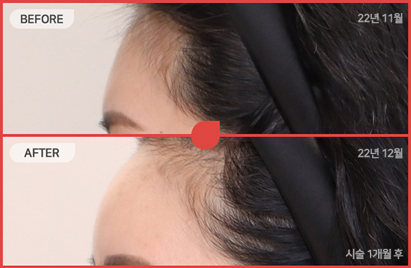 ด้านข้างของใบหน้า