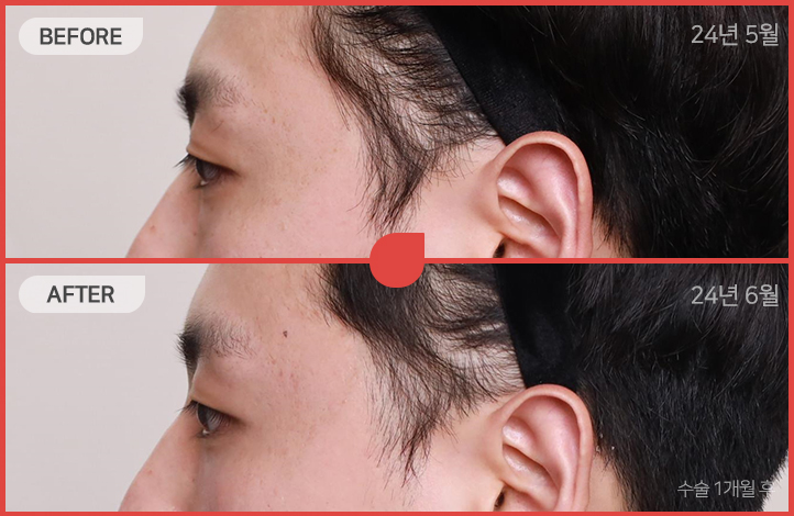 ด้านข้างของใบหน้า