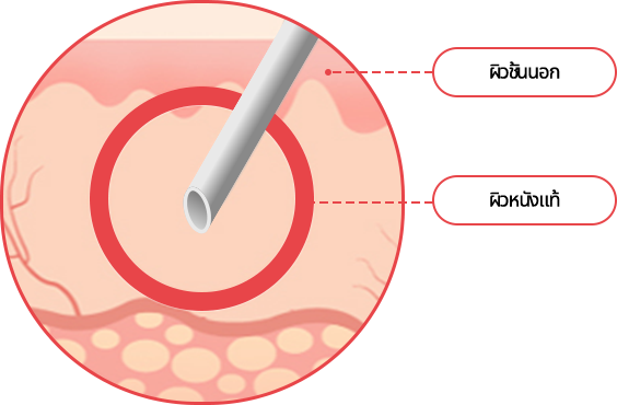 hand_img02 comparison02