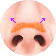 nose_type17