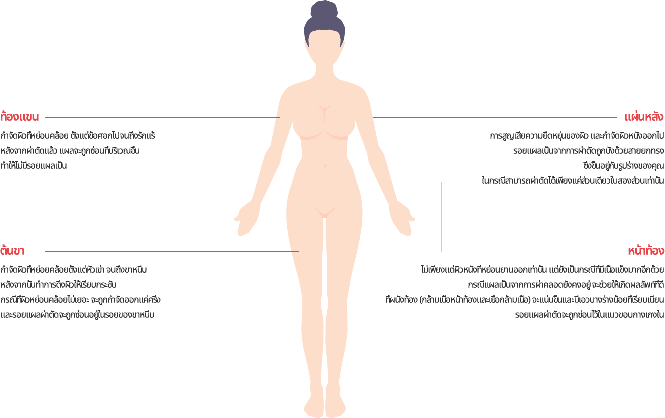 body_lift model img