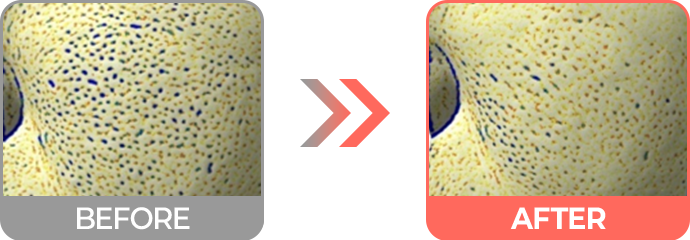 리투오 효과 모공 크기 감소