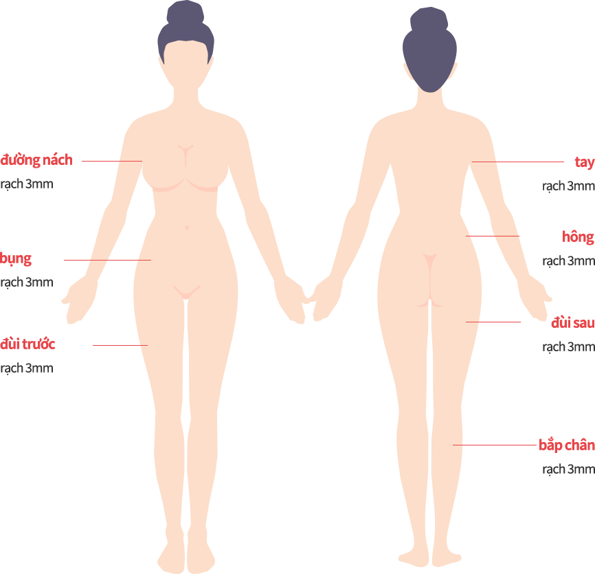 body_lip01_m model img