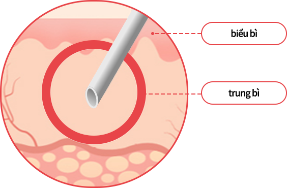 hand_img02 comparison02