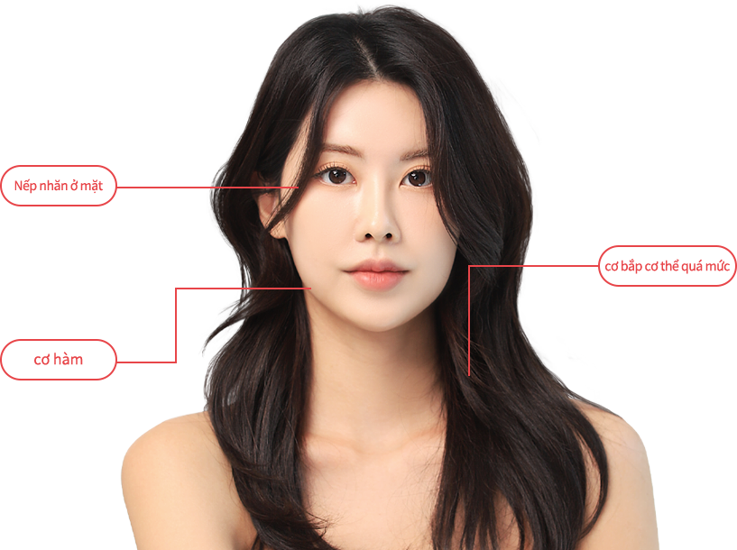 BotulinumToxin region model img
