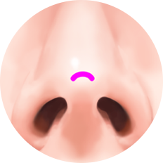 nose_type18