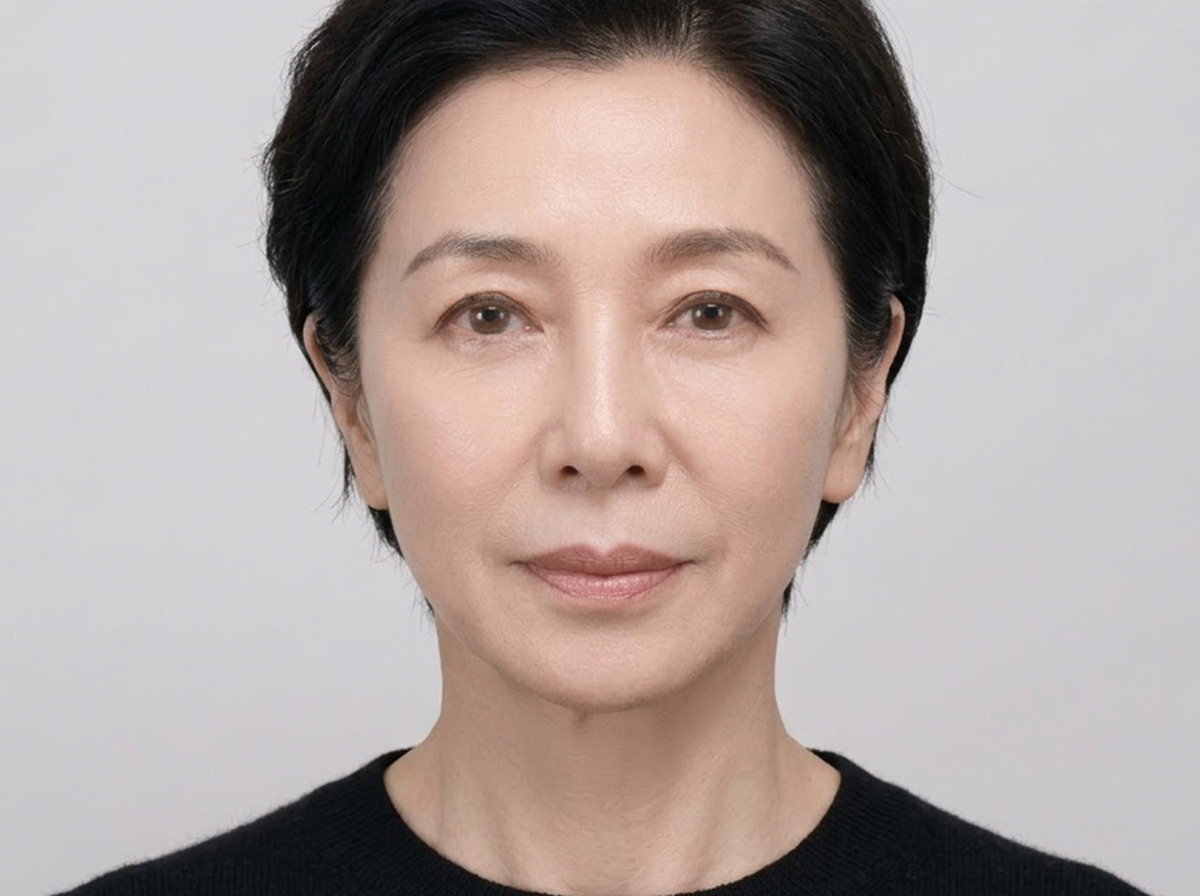 커스텀 리프팅 비교 이미지 후